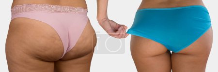 Foto de Progreso de la dieta con sobrepeso, mujer de cerca sobre fondo blanco. - Imagen libre de derechos
