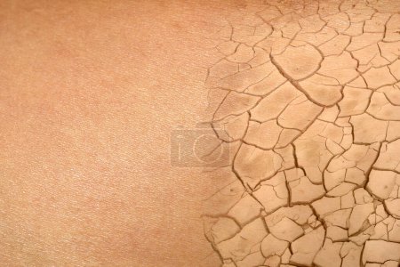 Photo for Beautiful healty skin under dehydrated. Dried skin concept - Royalty Free Image