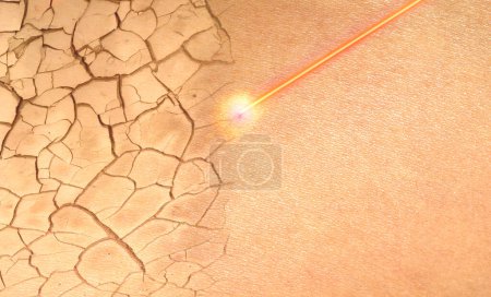 Photo for Concept repair damaged skin with a laser - Royalty Free Image