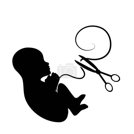 Vector illustration of abortion fetus on white background. Sign of premature birth and miscarriage.