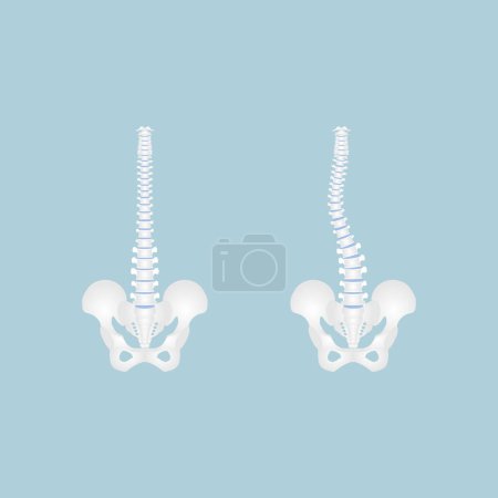 anatomy of human spine, spinal cord, scoliosis, internal organs body part orthopedic health care, vector illustration cartoon flat character design clip art isolated