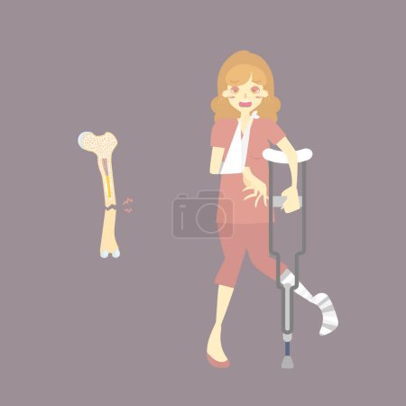Illustration for Sad patient with cast on broken leg and arm bone holding crutch, walking aid, internal organs body part orthopedic healthcare, fracture concept, flat vector illustration character cartoon design - Royalty Free Image