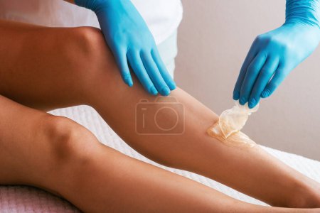 Foto de Manos de un cosmetólogo de cerca, con guantes azules, aplicando pasta de azúcar en la pierna de una mujer. Procedimiento de depilación con pasta de azúcar. depilación. Detalles del proceso de depilación. Cosmetólogo profesional - Imagen libre de derechos