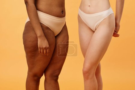 Foto de Estudio plano de caderas y muslos de dos mujeres jóvenes diversas en ropa interior, positividad corporal y concepto de salud de las mujeres - Imagen libre de derechos