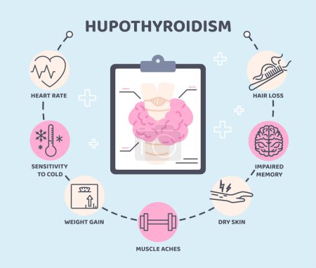 Illustration for Thyroid infographic concept. Visualization of medical advice. Health care and medicine. Syndromes of hypothyroidism. Sensitivity to cold, muscles aches and hair loss. Cartoon flat vector illustration - Royalty Free Image