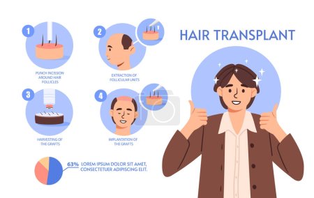 Hair transplant infographic concept. Medical education materials. Man transplanted his hair. Beauty and aesthetics. Treatment of alopecia and hairloss. Cartoon flat vector illustration