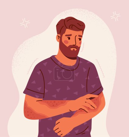 Illustration for Man with skin problem. Young girl scretching her hand. Character with acne and allergy. Healthcare and medicine, skincare. Bearded person with problems with derma. Cartoon flat vector illustration - Royalty Free Image