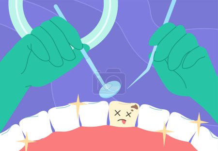 Illustration for Dentist remove tooth with caries. Hands in green ruber gloves with stomatology equipment. Mirror with reflection. Health care and medicine. Oral hygiene. Cartoon flat vector illustration - Royalty Free Image
