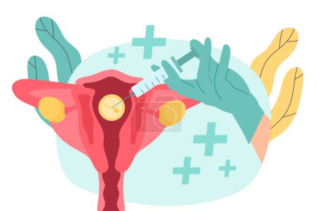 Illustration for Artificial insemination concept. Hand in protective gloves with syringe with sperm. Anatomy and biology. Female reproductive system and fertility. Cartoon flat vector illustration - Royalty Free Image