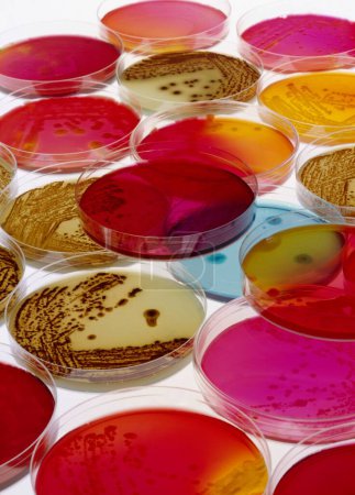 Foto de Platos de Petri con bacterias - Imagen libre de derechos