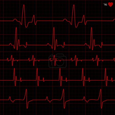 Illustration for Heart rate monitor with cardiogram and red line. medical cardiogram. - Royalty Free Image