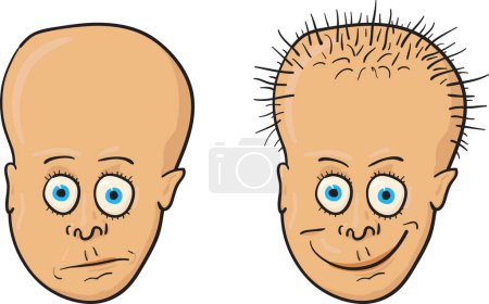 Téléchargez les illustrations : Illustration vectorielle comique - un patient avec un crâne chauve et de la croissance des cheveux - en licence libre de droit