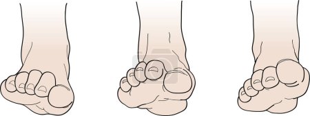 Ilustración de Ilustración vectorial de pies humanos sobre fondo blanco - Imagen libre de derechos