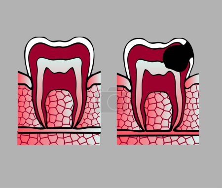 Ilustración de Icono del vector dental. diseño del logo dental - Imagen libre de derechos