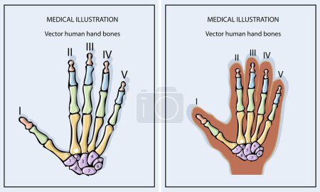 Ilustración de Esqueleto humano huesos de la mano anatomía vector - Imagen libre de derechos