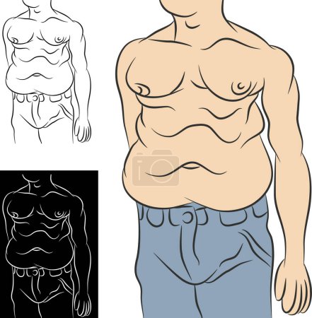 Téléchargez les illustrations : Forme du corps masculin gras, homme en surpoids, illustration vectorielle - en licence libre de droit