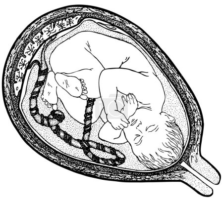 Foto de El bebé está durmiendo dentro de la ilustración del vientre - Imagen libre de derechos