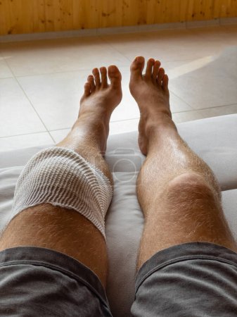 Photo for VERTICAL, POV: Male patient in home care after knee drainage surgery rests his leg on his leather couch. Looking down at your knee wrapped in white bandages after a meniscus surgery. Post-surgery rest - Royalty Free Image