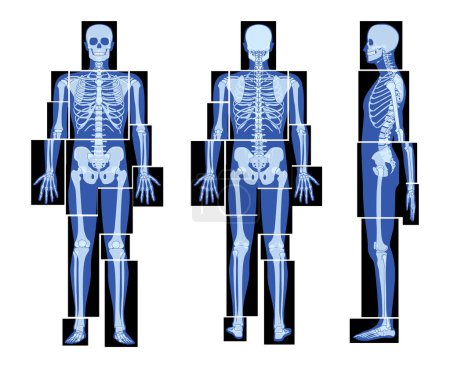 Illustration for Set of X-Ray Skeleton Human body parts - hands, legs, chest, head, vertebra, pelvis, Bones adult people roentgen front back side view. 3D realistic flat concept Vector illustration of medical anatomy - Royalty Free Image