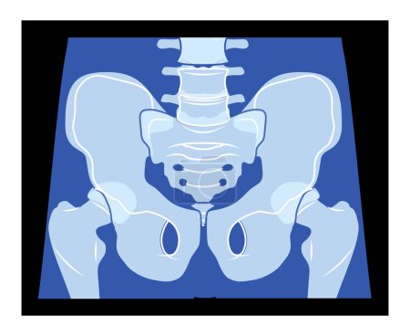 Röntgen-Becken-Skelett Hüfte Menschlicher Körper Knochen erwachsener Menschen Röntgen Vorderansicht. 3D realistisches flaches blaues Farbkonzept Vektor-Illustration der medizinischen Anatomie isoliert auf schwarzem Hintergrund