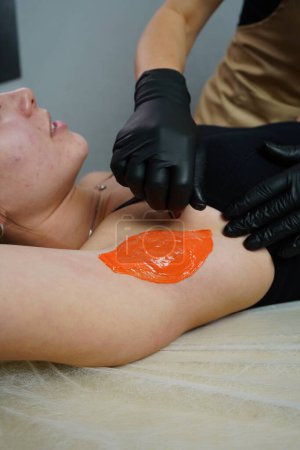 Master in black medical gloves applies a Wax on the client's Armpit. Depilation with wax. Waxing - hair removal