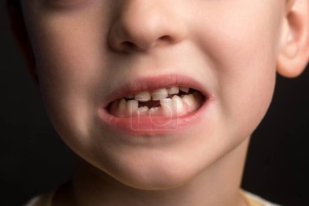 Foto de Niño de apariencia europea, leche y molares de cerca. foto horizontal - Imagen libre de derechos