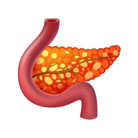 Ilustración de Pancreas of human . Digestive system . Realistic design . Isolated . Vector illustration . - Imagen libre de derechos