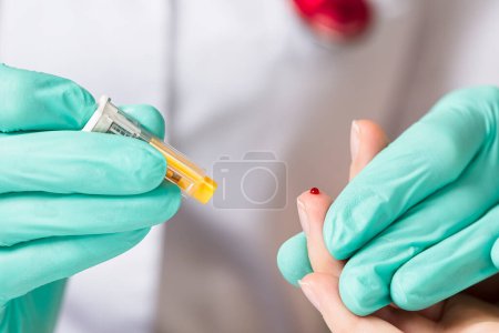 Foto de Doctor piercing pacientes dedo con lanceta en primer plano clínica. Tomando sangre para un análisis de cerca, un análisis clínico de sangre. Pinchazo de dedo - Imagen libre de derechos
