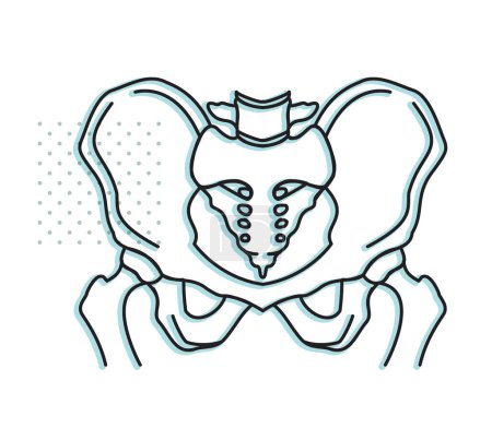 Téléchargez les illustrations : Arthrose - articulation de la hanche - Illustration de stock sous forme de fichier EPS 10 - en licence libre de droit