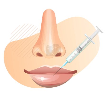 Inyección de toxina botulínica en los labios - Ilustración de stock como archivo EPS 10