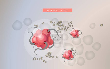 Virus de la variole du singe Illustration de stock comme fichier EPS 10