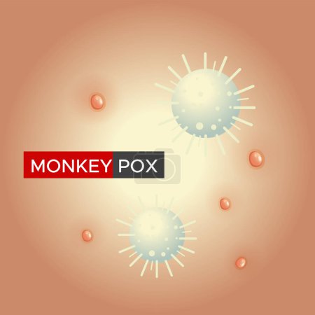 Foto de Monkeypox - Skin Rashes and Spots as Symptoms - Icon as EPS 10 File - Imagen libre de derechos