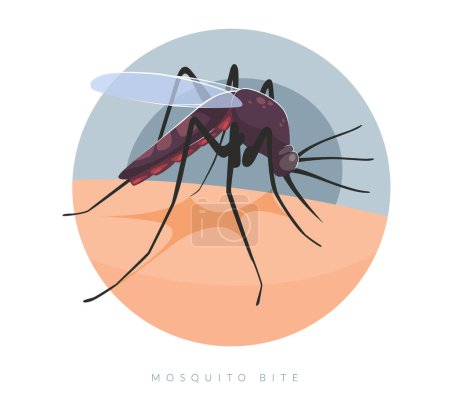 Foto de Picadura de mosquitos en la piel humana - Ilustración de stock como archivo EPS 10 - Imagen libre de derechos