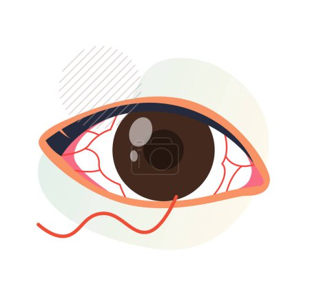 Infection conjonctivite oculaire - ?il rose - Icône en tant que fichier EPS 10