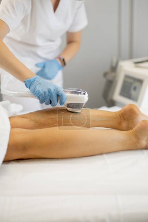 Foto de Procedimiento de depilación láser en las piernas de una mujer, primer plano en la pierna. Concepto de depilación y procedimientos de belleza - Imagen libre de derechos