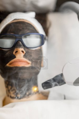 Téléchargez les photos : Procédure de beauté de peeling au carbone laser sur le visage des femmes. Gros plan sur le visage des clients avec un masque en carbone et des lunettes de protection. Concept de soins du visage beauté - en image libre de droit
