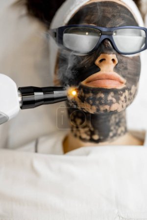 Téléchargez les photos : Procédure de beauté de peeling au carbone laser sur le visage des femmes. Gros plan sur le visage des clients avec un masque en carbone et des lunettes de protection. Concept de soins du visage beauté - en image libre de droit