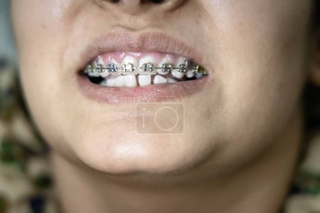 Téléchargez les photos : Jeune fille montrant ses dents accolade dentiste sous un angle différent - en image libre de droit