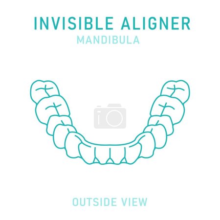 Illustration for Orthodontic silicone trainer. Invisible braces aligner, retainer. Medical scheme. Outside view. Under jaw. Mandibula. Horizontal poster. Editable vector illustration isolated on a white background. - Royalty Free Image