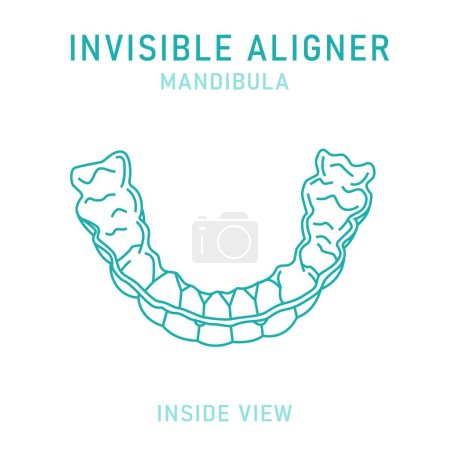 Illustration for Orthodontic silicone trainer. Invisible braces aligner, retainer. Medical scheme. Inside view. Under jaw. Mandibula. Horizontal poster. Editable vector illustration isolated on a white background. - Royalty Free Image