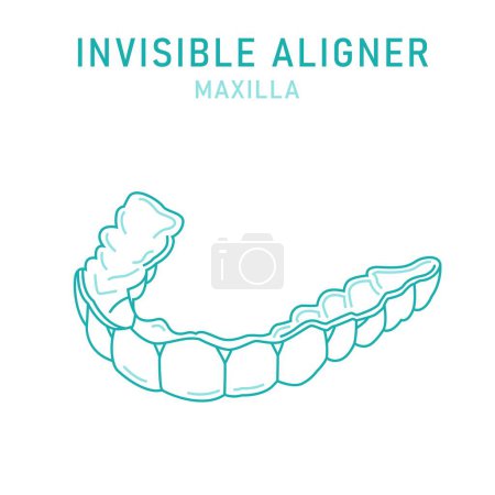 Illustration for Orthodontic silicone trainer. Invisible braces aligner, retainer. Medical scheme. Outside view. Upper jaw. Maxilla. Horizontal poster. Editable vector illustration isolated on a white background. - Royalty Free Image