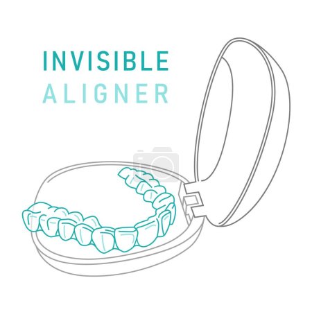 Illustration for Orthodontic silicone trainer. Invisible braces aligner, retainer. Medical treatment. Opened tray. Plastic case with transparent braces. Editable vector illustration isolated on a white background. - Royalty Free Image