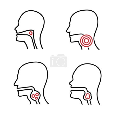 Illustration for Dysphagia linear icon. Aphagia line pictogram. Difficulty in swallowing symbol. Deglutitive problem. Medical sign in outline style. Editable vector illustration isolated on a white background. - Royalty Free Image