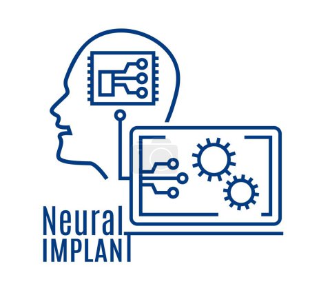 Illustration for Implantation of a neural chip into the human brain. Interface between human brain and computer. Linear design. Graphic banner. Editable vector illustration isolated on a white background - Royalty Free Image