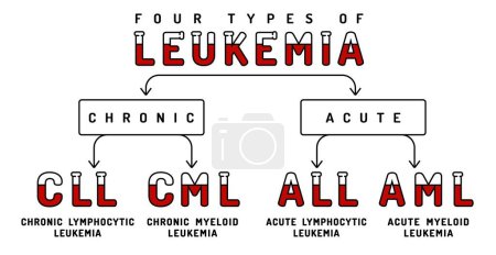 Four types of leukemia. Acute myeloid, chronic lymphocytic type. Blood cancer infographics. Hematology concept. Landscape poster. Editable vector illustration in linear style on a white background
