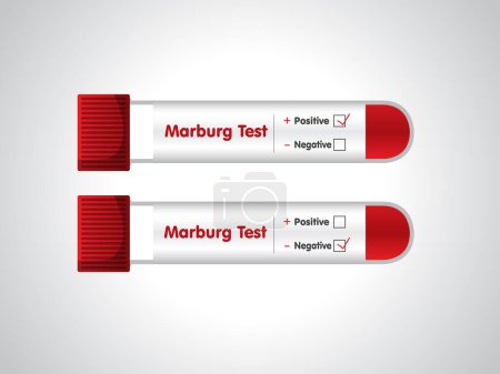 Symptoms or precautions. MARBURG virus blood test tube Vector Illustration. 
