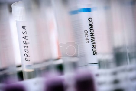 Téléchargez les photos : Plusieurs flacons contenant des protéines protéases solubles pour l'activation de la protéine de type trypsine du syndrome respiratoire aigu sévère (SRAS) du coronavirus chez l'homme - en image libre de droit