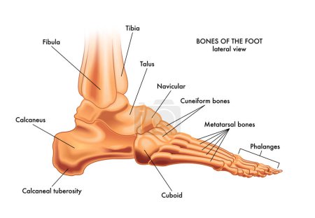 Ilustración médica de las partes principales de los huesos del pie a la vista lateral, con anotaciones.