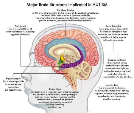 Ilustración médica que muestra las principales estructuras cerebrales implicadas en el trastorno del espectro autista, con anotaciones.