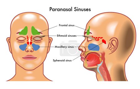 Illustration for Medical diagram of Paranasal Sinuses in the human head. - Royalty Free Image